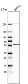 Anti-SPOUT1 antibody produced in rabbit Prestige Antibodies&#174; Powered by Atlas Antibodies, affinity isolated antibody, buffered aqueous glycerol solution