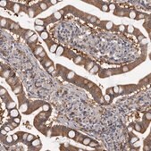 Anti-FGFR4 antibody produced in rabbit Prestige Antibodies® Powered by Atlas Antibodies, affinity isolated antibody, buffered aqueous glycerol solution
