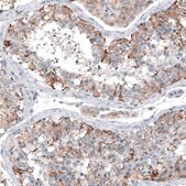Anti-CEP192 antibody produced in rabbit Prestige Antibodies&#174; Powered by Atlas Antibodies, affinity isolated antibody, buffered aqueous glycerol solution