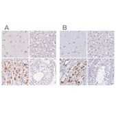 Anti-KCNE2 antibody produced in rabbit Prestige Antibodies® Powered by Atlas Antibodies, affinity isolated antibody, buffered aqueous glycerol solution