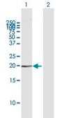 Anti-HMGA1 antibody produced in mouse purified immunoglobulin, buffered aqueous solution
