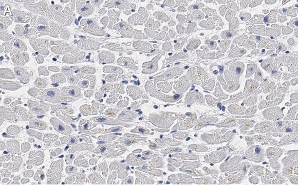 Anti-Cardiac Troponin I Antibody, clone 1F23, ZooMAb&#174; Rabbit Monoclonal recombinant, expressed in HEK 293 cells