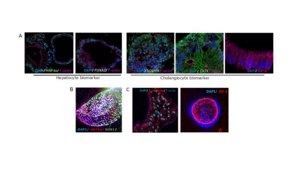 3dGRO® Human Liver Organoids (MNFBQ01LI (71-73)) Normal, Liver, Age: 51, Female, Mutation: None