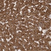 Anti-MUT antibody produced in rabbit Prestige Antibodies&#174; Powered by Atlas Antibodies, affinity isolated antibody, buffered aqueous glycerol solution