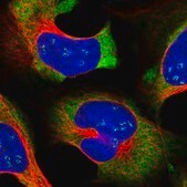 Anti-LARP4 antibody produced in rabbit Prestige Antibodies&#174; Powered by Atlas Antibodies, affinity isolated antibody, buffered aqueous glycerol solution