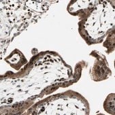 Anti-IP6K2 antibody produced in rabbit Prestige Antibodies&#174; Powered by Atlas Antibodies, affinity isolated antibody, buffered aqueous glycerol solution