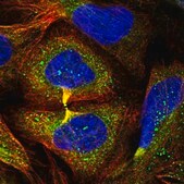 Anti-AHSA2 antibody produced in rabbit Prestige Antibodies&#174; Powered by Atlas Antibodies, affinity isolated antibody, buffered aqueous glycerol solution