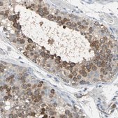 Anti-DLGAP5 antibody produced in rabbit Prestige Antibodies&#174; Powered by Atlas Antibodies, affinity isolated antibody, buffered aqueous glycerol solution