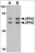 Anti-JPH2 (ab2) antibody produced in rabbit affinity isolated antibody, buffered aqueous solution