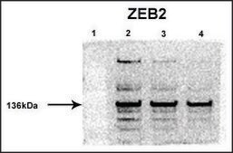Anti-ZEB2 affinity isolated antibody