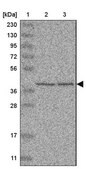 Anti-UROD antibody produced in rabbit Prestige Antibodies&#174; Powered by Atlas Antibodies, affinity isolated antibody, buffered aqueous glycerol solution