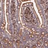 Anti-PPP2R3C antibody produced in rabbit Prestige Antibodies&#174; Powered by Atlas Antibodies, affinity isolated antibody, buffered aqueous glycerol solution