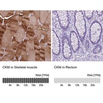 Anti-CKM antibody produced in rabbit Prestige Antibodies&#174; Powered by Atlas Antibodies, affinity isolated antibody, buffered aqueous glycerol solution