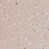 Anti-GNL3L antibody produced in rabbit Prestige Antibodies&#174; Powered by Atlas Antibodies, affinity isolated antibody, buffered aqueous glycerol solution