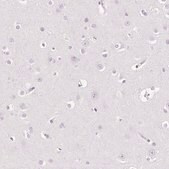 Anti-EHHADH antibody produced in rabbit Prestige Antibodies&#174; Powered by Atlas Antibodies, affinity isolated antibody, buffered aqueous glycerol solution