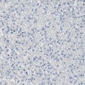Anti-DMPK antibody produced in rabbit Ab1, Prestige Antibodies&#174; Powered by Atlas Antibodies, affinity isolated antibody, buffered aqueous glycerol solution