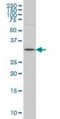 Monoclonal Anti-C9orf61 antibody produced in mouse clone 1H3, purified immunoglobulin, buffered aqueous solution