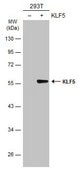 Anti-KLF5 antibody produced in rabbit