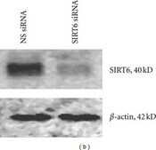 Anti-Sirt6 (C-terminal) antibody produced in rabbit ~1 mg/mL, affinity isolated antibody, buffered aqueous solution
