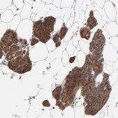 Anti-PPFIBP2 antibody produced in rabbit Ab2, Prestige Antibodies&#174; Powered by Atlas Antibodies, affinity isolated antibody, buffered aqueous glycerol solution