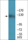 Anti-phospho-Abl (pTyr412) antibody produced in rabbit affinity isolated antibody