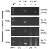 mEER Mouse E6/E7/hRas Oropharynx Epithelial Cell Line