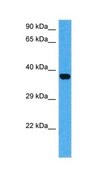 Anti-ATF4, (C-terminal) antibody produced in rabbit affinity isolated antibody