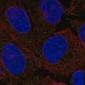 Anti-FANCL antibody produced in rabbit Prestige Antibodies&#174; Powered by Atlas Antibodies, affinity isolated antibody, buffered aqueous glycerol solution