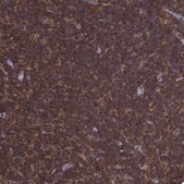 Anti-DOCK10 antibody produced in rabbit Prestige Antibodies® Powered by Atlas Antibodies, affinity isolated antibody