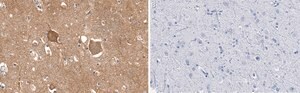 Anti-Trk-B Antibody, clone 2B22 ZooMAb&#174; Rabbit Monoclonal recombinant, expressed in HEK 293 cells