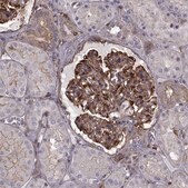 Anti-MYH9 antibody produced in rabbit Prestige Antibodies&#174; Powered by Atlas Antibodies, affinity isolated antibody, buffered aqueous glycerol solution