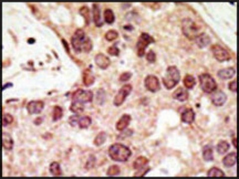 抗 PRDM9（C-术语） 兔抗 IgG fraction of antiserum, buffered aqueous solution