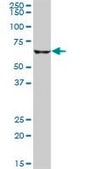 Anti-CPT2 antibody produced in mouse purified immunoglobulin, buffered aqueous solution