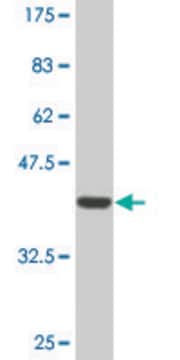 Monoclonal Anti-DSCR1 antibody produced in mouse clone 1G7, ascites fluid