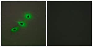 Anti-Cytochrome P450 19A1 antibody produced in rabbit affinity isolated antibody