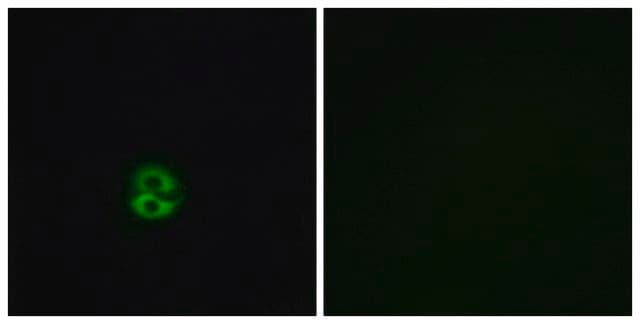 Anti-CHST6 antibody produced in rabbit affinity isolated antibody