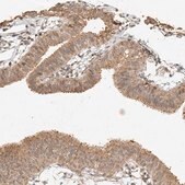 Anti-CXorf58 antibody produced in rabbit Prestige Antibodies&#174; Powered by Atlas Antibodies, affinity isolated antibody, buffered aqueous glycerol solution