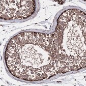 Anti-GFM1 antibody produced in rabbit Prestige Antibodies&#174; Powered by Atlas Antibodies, affinity isolated antibody, buffered aqueous glycerol solution