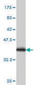 Monoclonal Anti-CYB5R4 antibody produced in mouse clone 1E8, purified immunoglobulin, buffered aqueous solution