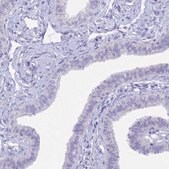 Anti-CGB3 antibody produced in rabbit Prestige Antibodies® Powered by Atlas Antibodies, affinity isolated antibody, buffered aqueous glycerol solution