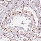Anti-TRERF1 antibody produced in rabbit Prestige Antibodies&#174; Powered by Atlas Antibodies, affinity isolated antibody, buffered aqueous glycerol solution