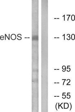 Anti-ENOS antibody produced in rabbit affinity isolated antibody