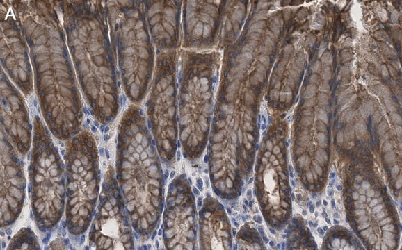 Anti-Calpain-9 Antibody, clone 1J22 ZooMAb&#174; Rabbit Monoclonal recombinant, expressed in HEK 293 cells