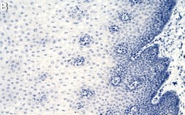 Anti-MBNL1 Antibody, clone 4A8 ZooMAb&#174; Mouse Monoclonal recombinant, expressed in HEK 293 cells