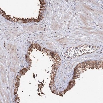 Anti-RRP9 antibody produced in rabbit Prestige Antibodies&#174; Powered by Atlas Antibodies, affinity isolated antibody, buffered aqueous glycerol solution