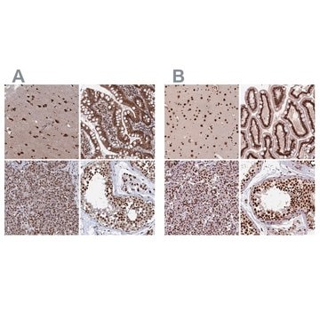 Anti-CTB-50L17.10 antibody produced in rabbit Prestige Antibodies® Powered by Atlas Antibodies, affinity isolated antibody, buffered aqueous glycerol solution