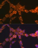Anti-67kDa Laminin Receptor Antibody, clone 2Q8Q6, Rabbit Monoclonal