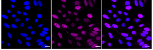 KD-Validated Anti RAD23A Antibody, clone 24GB1080, Rabbit Monoclonal clone 24GB1080, recombinant rabbit monoclonal, expressed in HEK293 cells
