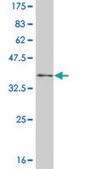 Monoclonal Anti-NFKBIB antibody produced in mouse clone 3E11, purified immunoglobulin, buffered aqueous solution