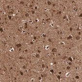 Anti-TECPR2 antibody produced in rabbit Prestige Antibodies&#174; Powered by Atlas Antibodies, affinity isolated antibody, buffered aqueous glycerol solution